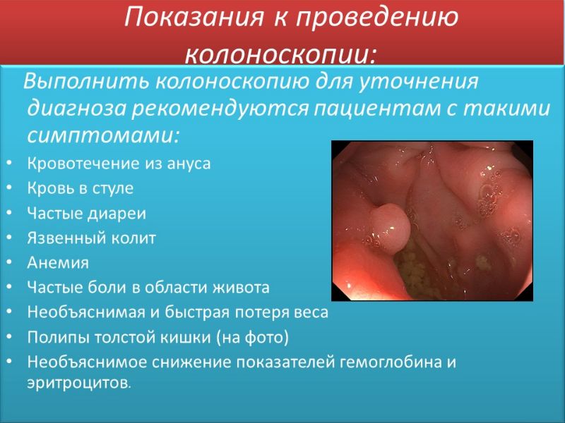 Кровь в стуле после колоноскопии