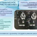 ЭхоКГ_слайд!4.jpg